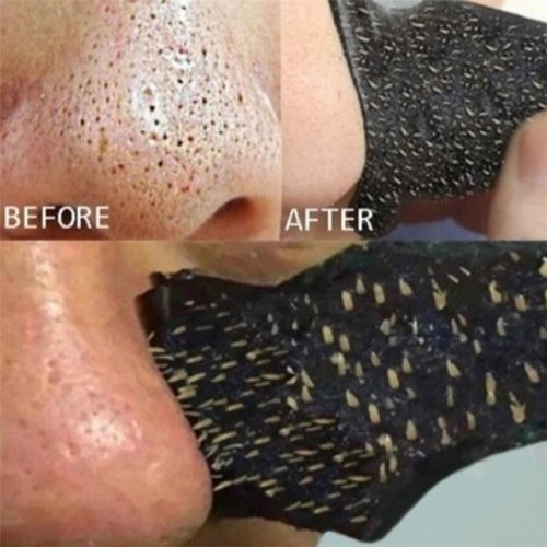 Nose Blackhead Remover Strips | Deep Cleansing Pore Strips for Clear Skin - Pack of 25